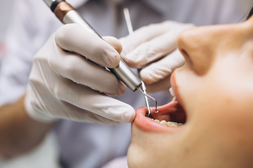 endodoncia fuenlabrada